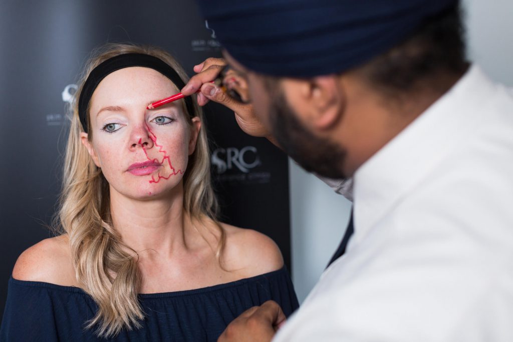 Patient receiving full face filler treatment