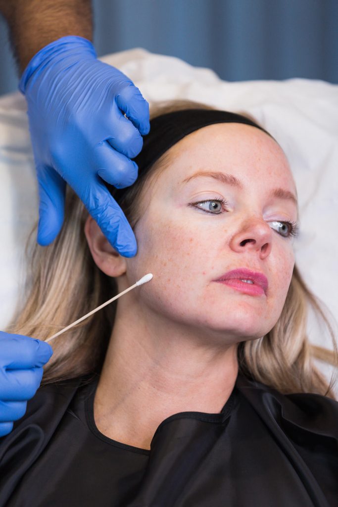 Patient receiving full face filler treatment